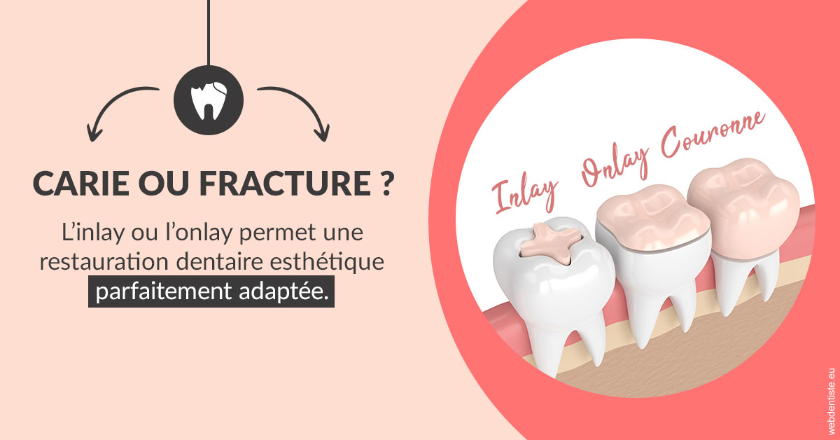 https://www.clinique-dentaire-elbelghiti.com/T2 2023 - Carie ou fracture 2