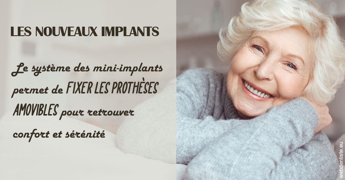 https://www.clinique-dentaire-elbelghiti.com/Les nouveaux implants 1