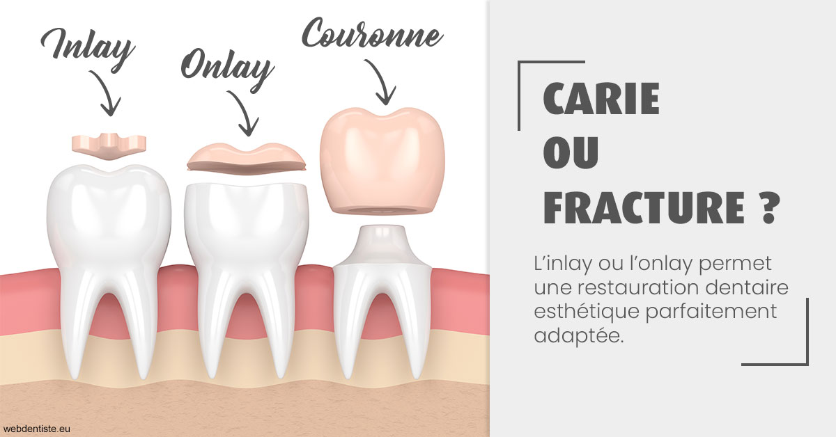 https://www.clinique-dentaire-elbelghiti.com/T2 2023 - Carie ou fracture 1