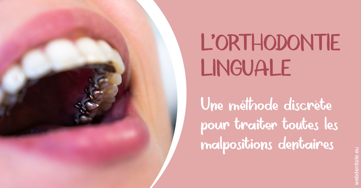 https://www.clinique-dentaire-elbelghiti.com/L'orthodontie linguale 2