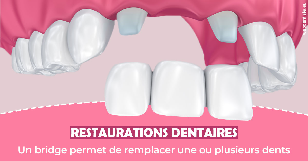 https://www.clinique-dentaire-elbelghiti.com/Bridge remplacer dents 2