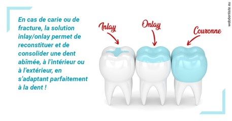 https://www.clinique-dentaire-elbelghiti.com/L'INLAY ou l'ONLAY