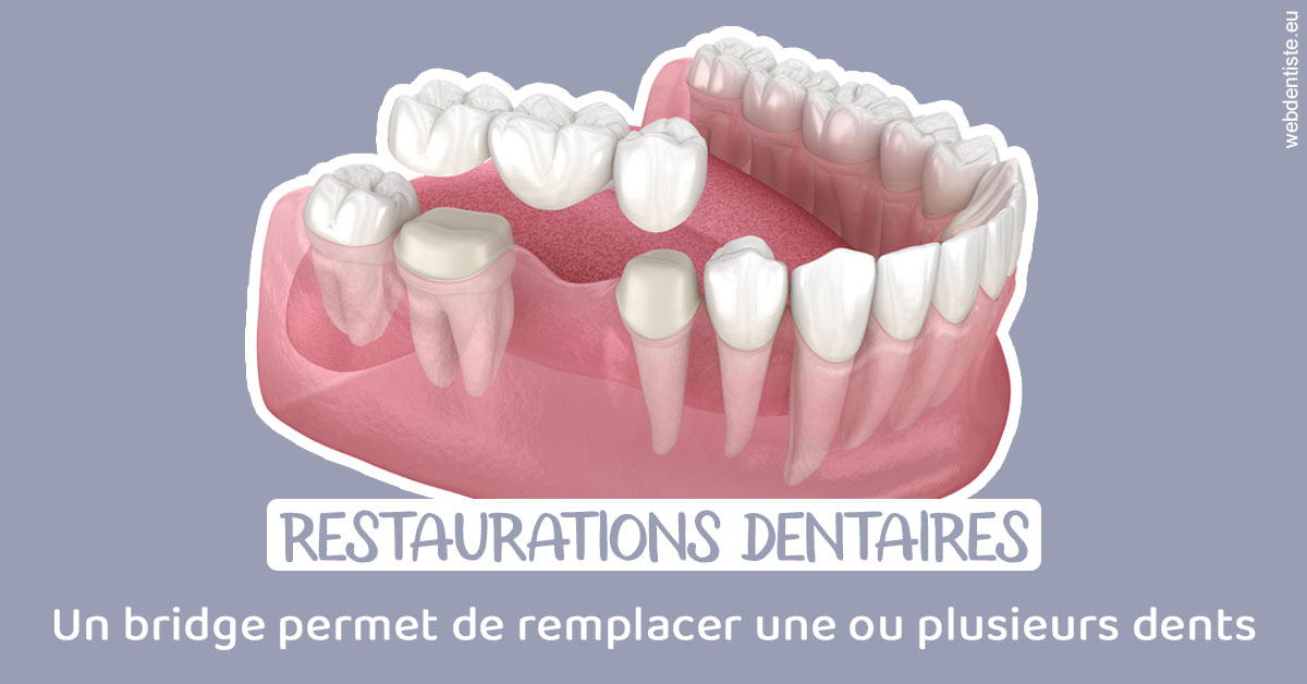 https://www.clinique-dentaire-elbelghiti.com/Bridge remplacer dents 1
