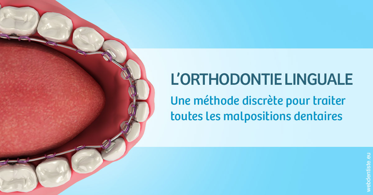 https://www.clinique-dentaire-elbelghiti.com/L'orthodontie linguale 1