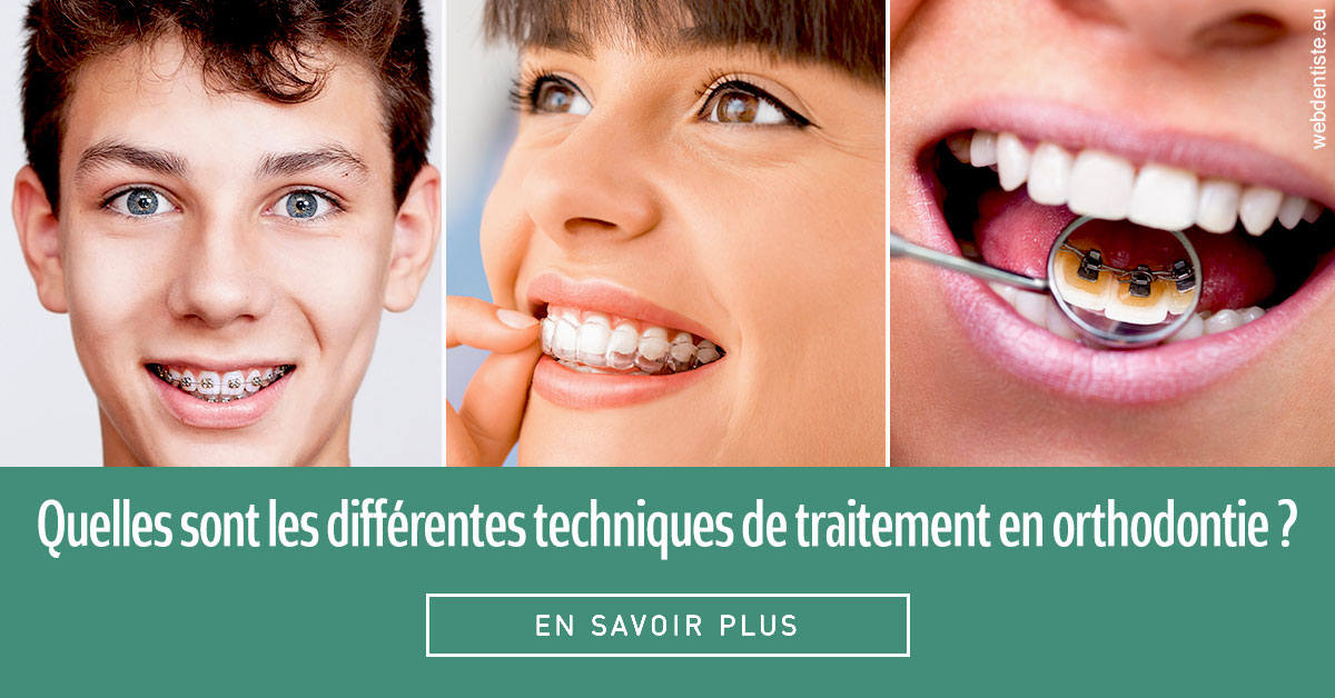 https://www.clinique-dentaire-elbelghiti.com/Les différentes techniques de traitement 2