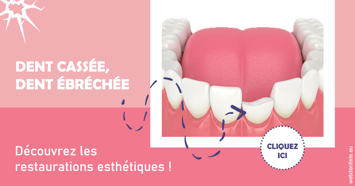 https://www.clinique-dentaire-elbelghiti.com/Dent cassée ébréchée 1