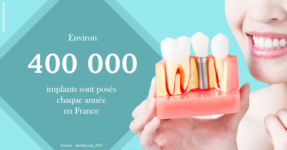 https://www.clinique-dentaire-elbelghiti.com/Pose d'implants en France 2