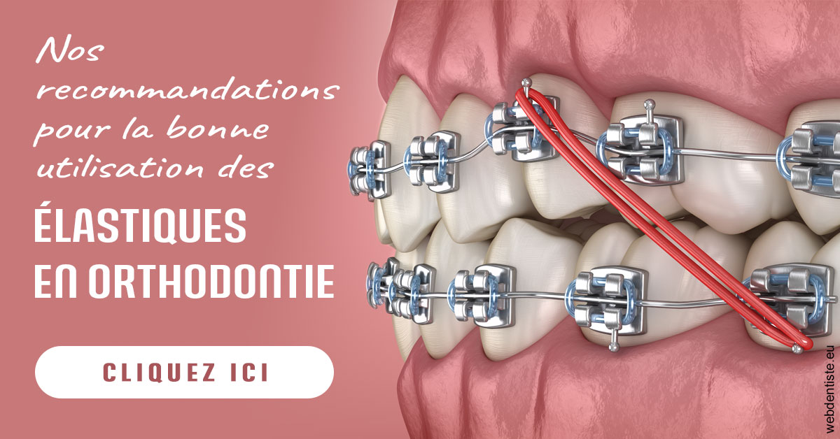 https://www.clinique-dentaire-elbelghiti.com/Elastiques orthodontie 2