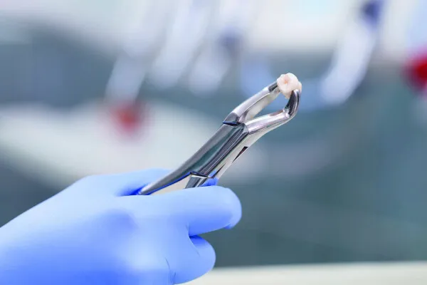 Extractions dentaires