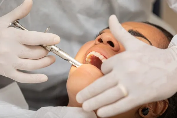 Extractions dentaires