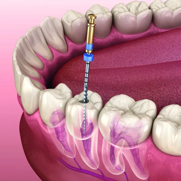 Endodontie