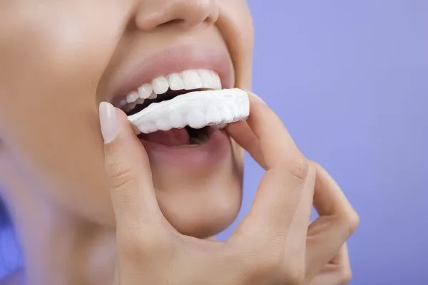 Eclaircissement dentaire